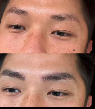 Two views of a male brow case shown in WaiTo’s portfolio